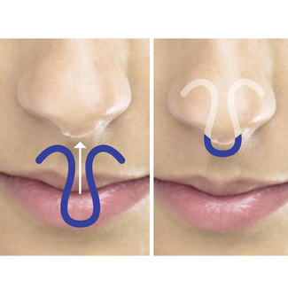 Maximex Antischnarch-Nasenclip ClipAir, erholsamer, gesunder Schlaf Maximex Antischnarch-Nasenclip ClipAir, erholsamer, gesunder Schlaf