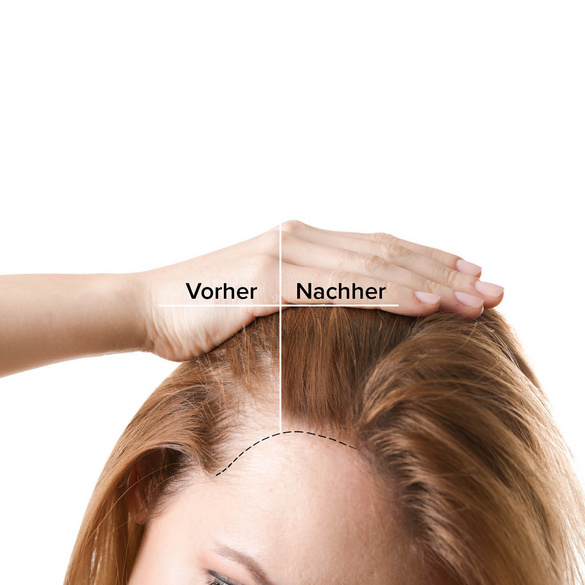 Haarverdicker-Volumenspray