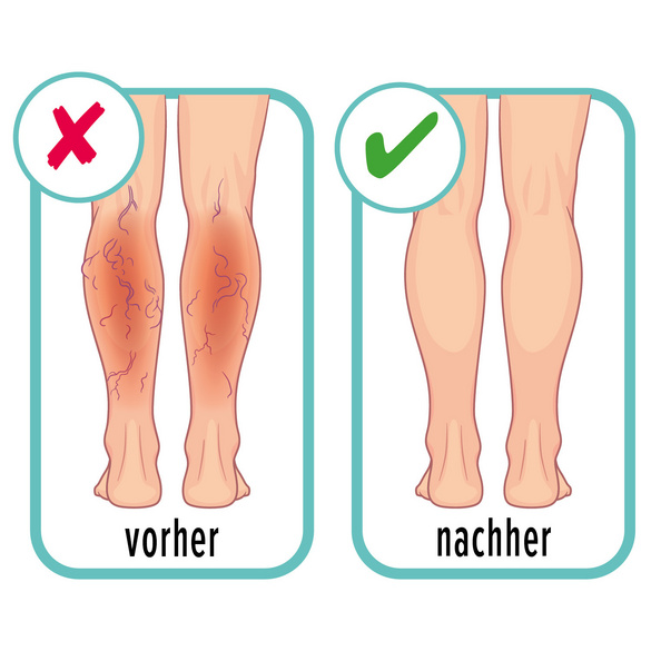 Luftkompressions-Beinmassage-Gerät